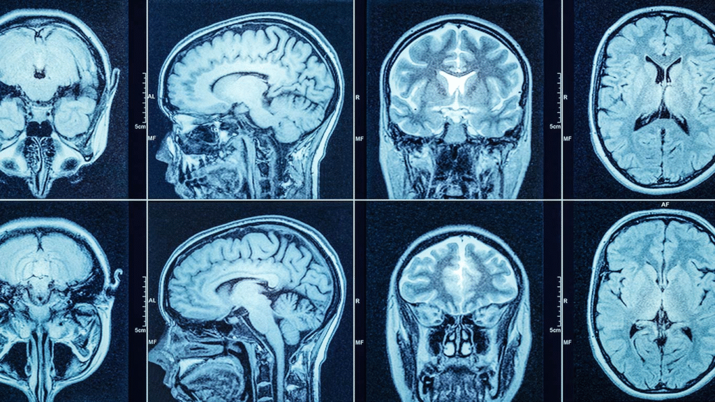 Why Are CT Scans Used?